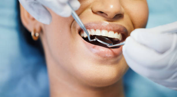 Best Emergency Root Canal Treatment in Bourbon, IN