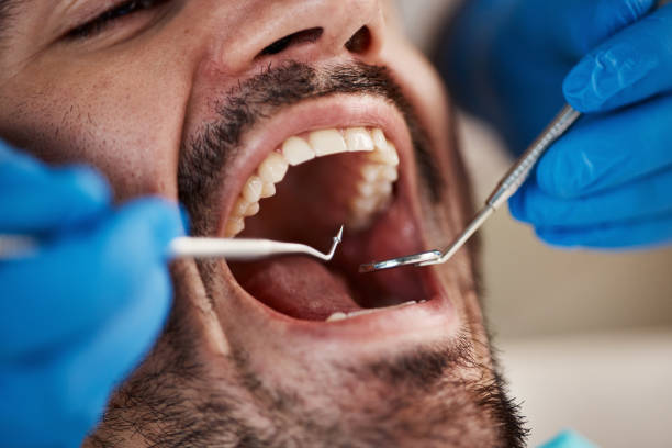Best Orthodontic Emergency Dentist in Bourbon, IN